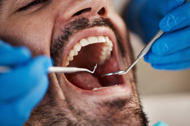 Emergency Dental Services in Rancho Mission Viejo, CA
